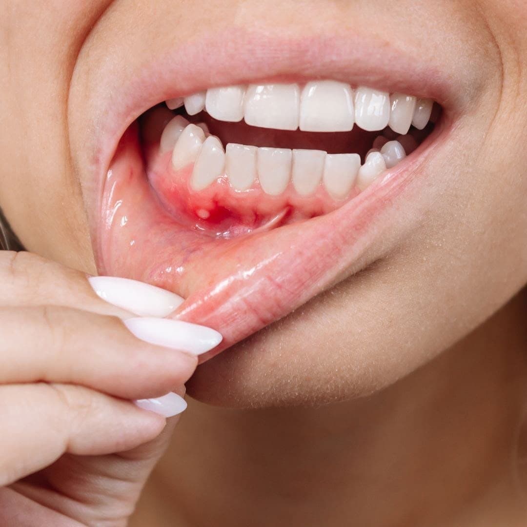 Gum Problems Treatment (Periodontal Care) — Clinical Dental Care at Dant काया Multispeciality Clinic, Patna