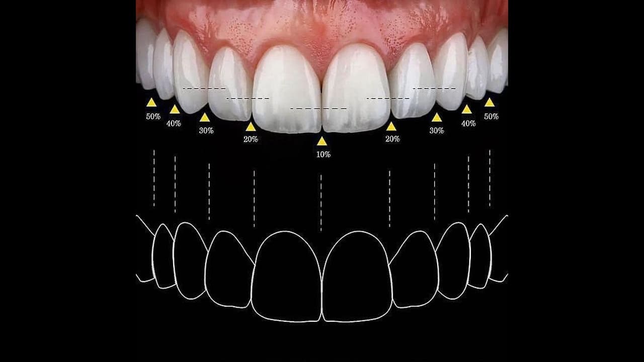 Smile Designing — Clinical Dental Care at Dant काया Multispeciality Clinic, Patna