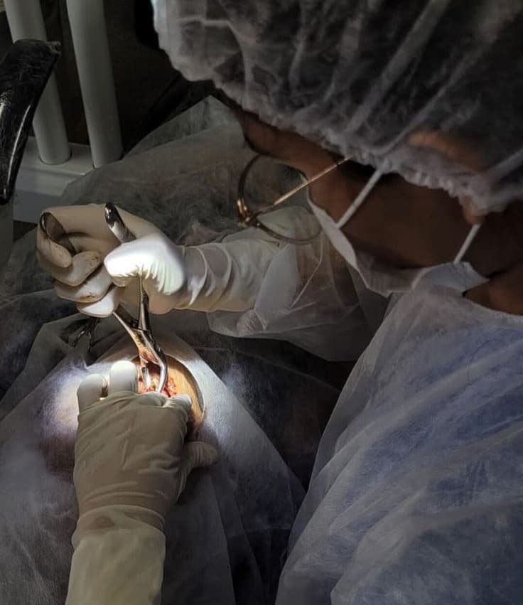 Oral Surgery (Major & Minor) — Clinical Dental Care at Dant काया Multispeciality Clinic, Patna