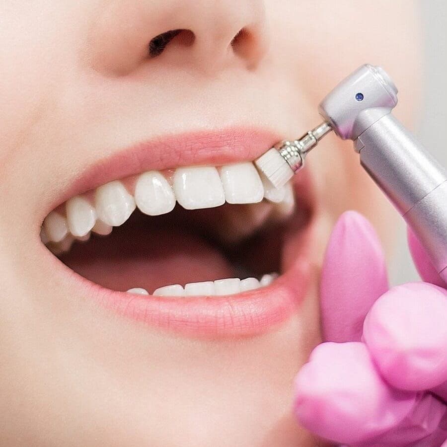 Teeth Cleaning (Ultrasonic Scaling & Polishing) — Clinical Dental Care at Dant काया Multispeciality Clinic, Patna